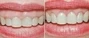 Periodontal Plastic Surgery Dentist South Africa